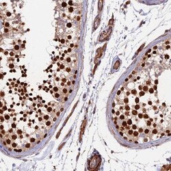 RALGAPA2 Antibody, Novus Biologicals 25 &mu;L | Buy Online | Novus Biologicals | Fisher Scientific